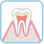 歯周病1